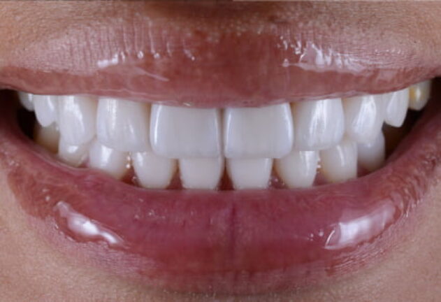 After - Dental Space