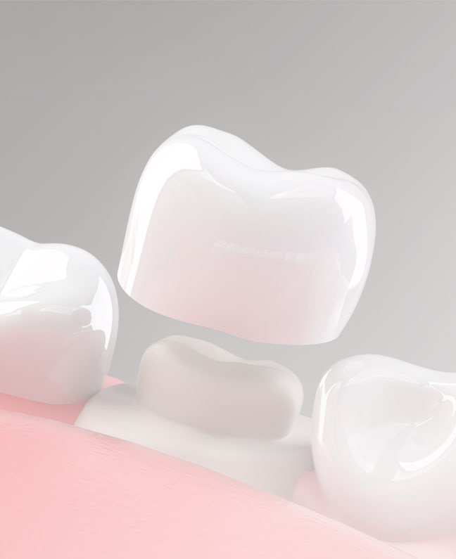 Treatment - Dental Space