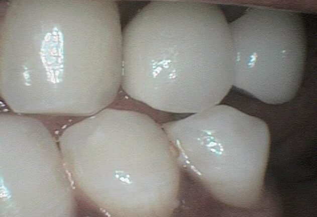 After - Dental Space
