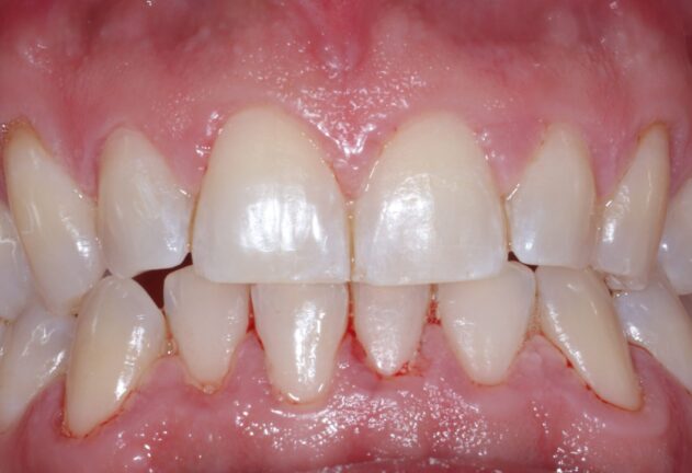 After - Dental Space