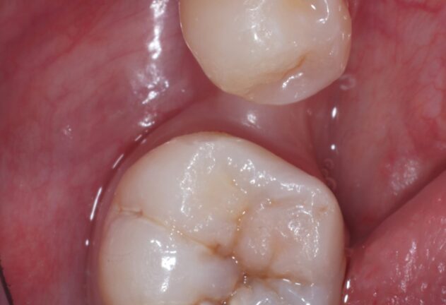 Before - Dental Space