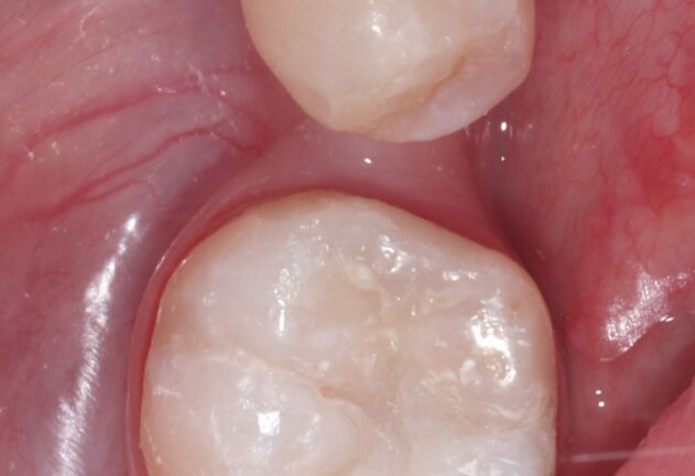 After - Dental Space