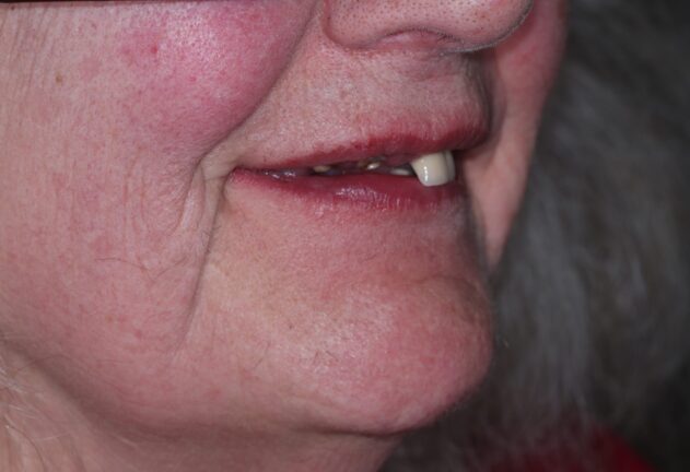 Before - Dental Space