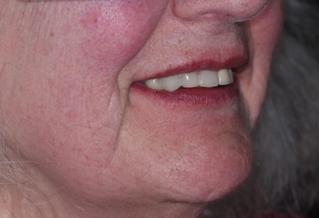 After - Dental Space