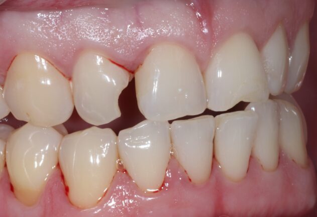 Before - Dental Space