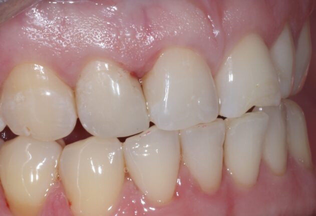 After - Dental Space